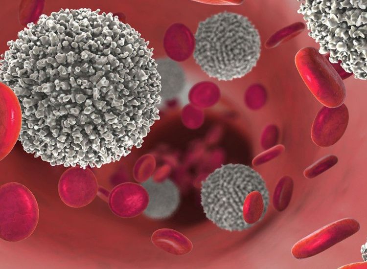 ابتكار روسي يزيد قوة علاج سرطان الدم بمقدار ثمانية أضعاف