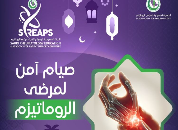 جمعية الروماتيزم: الصيام آمن لمرضى الروماتويد مع الالتزام الطبي